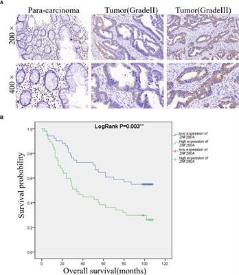 Downregulation of ZNF280A inhibits proliferation and tumorigenicity of colorectal cancer cells by promoting the ubiquitination and degradation of RPS14